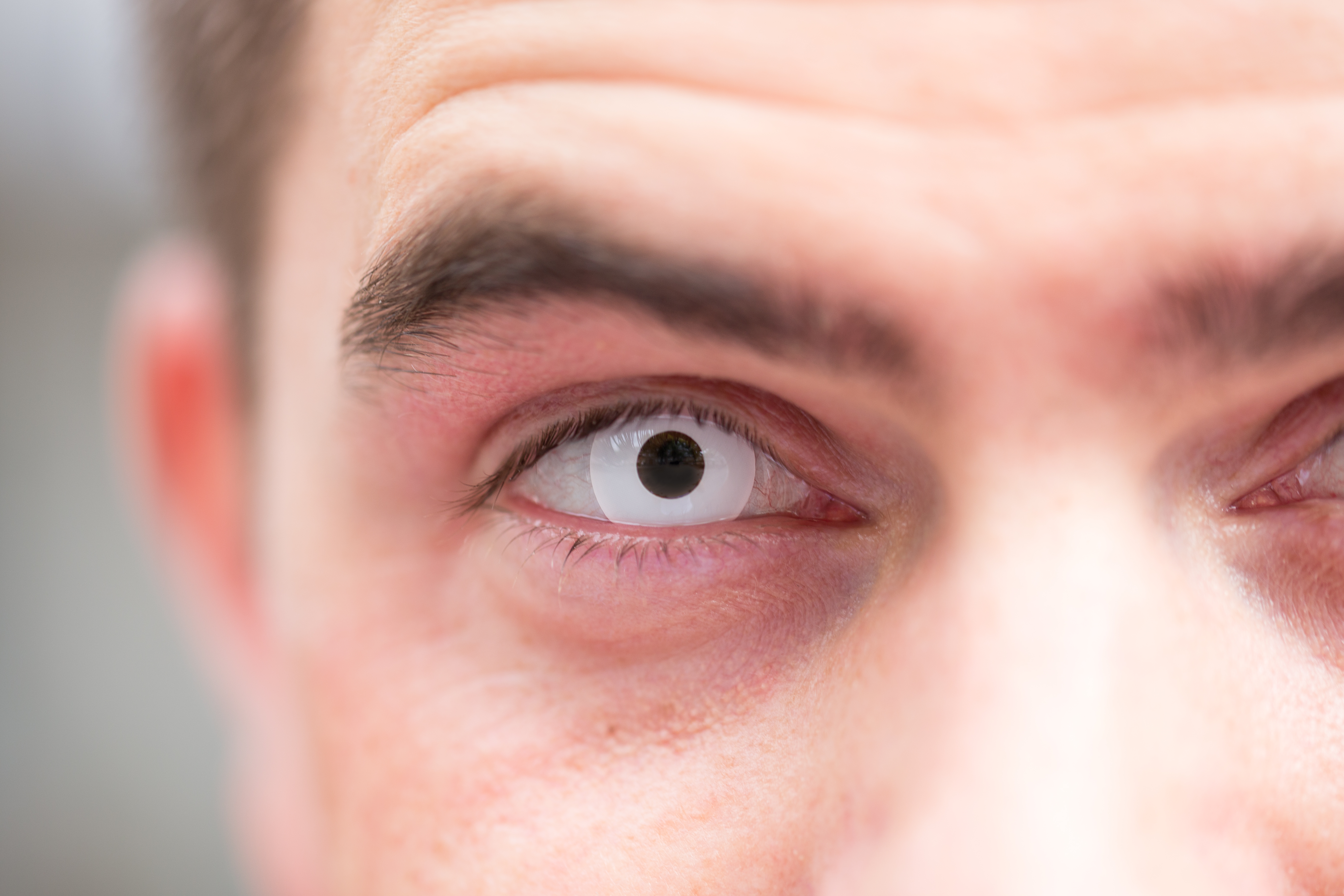 Farbige Kontaktlinsen: Mit diesen Tipps gibt's keine roten Augen